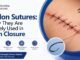 Nylon Sutures Image